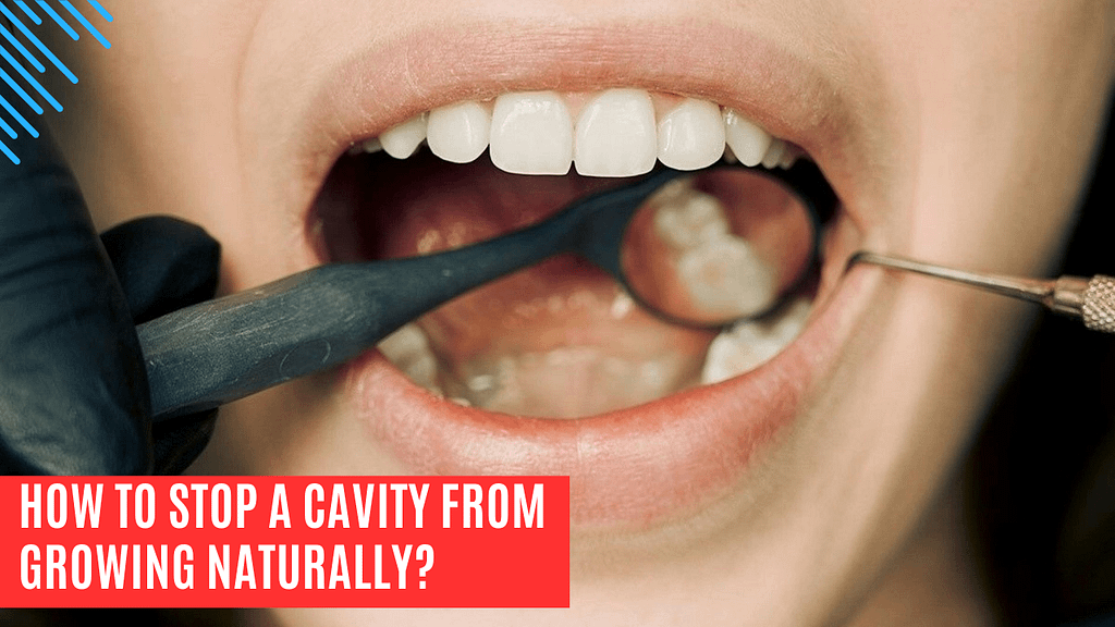 how to stop a cavity from growing naturally