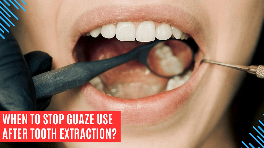 when to stop guaze use after tooth extraction