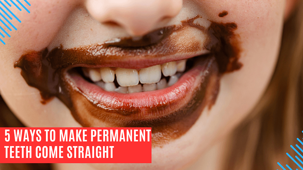 5 ways to make permanent teeth come straight