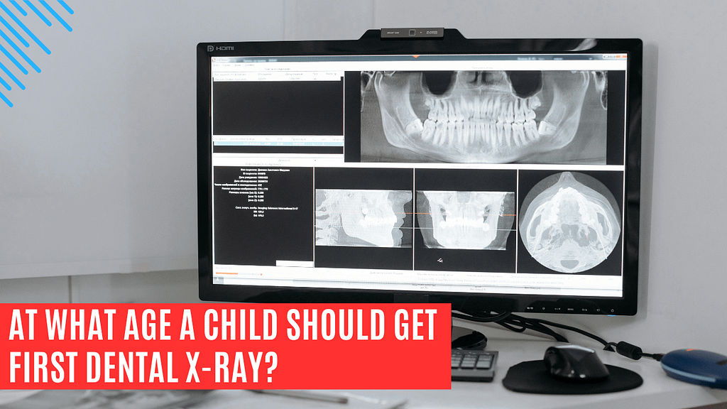 at what age should a child get first dental x ray