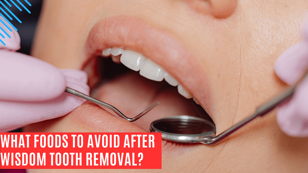 what foods to avoid after wisdom tooth removal