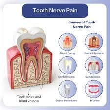 kill tooth pain nerve in 3 seconds permanently 